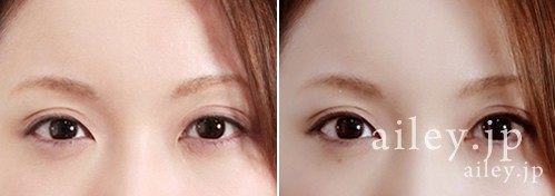 ai-line